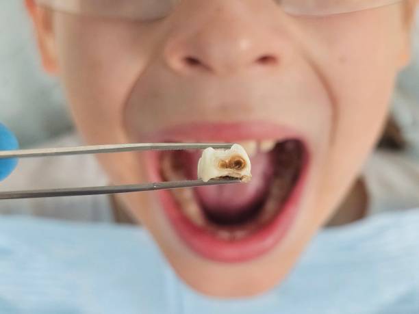 Best Tooth Infection Emergency Dentist  in Strongsville, OH